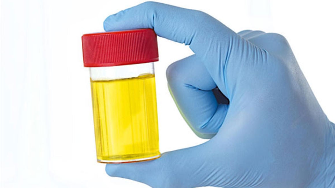 what-the-colour-of-your-urine-says-about-your-health-by-dr-l-k-jha