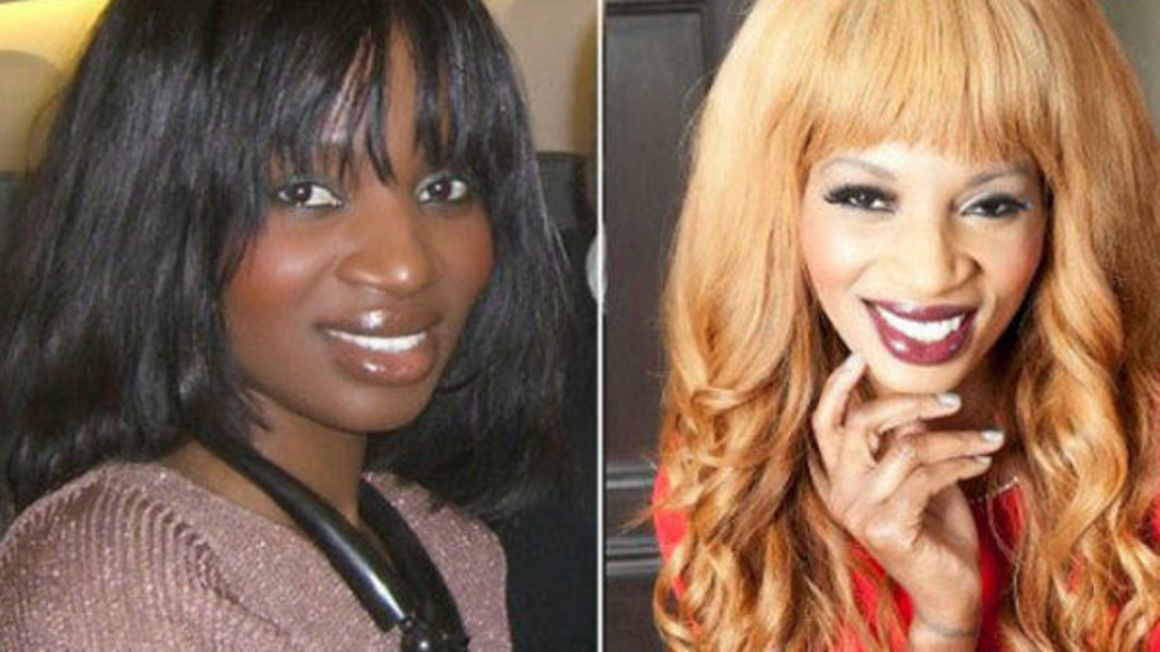 Skin bleaching in Africa A risky 'addiction' Daily Monitor